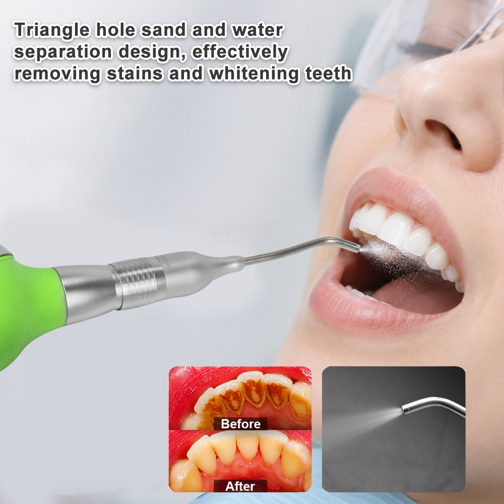 Polisseur dentaire à air compr - Teeth Whitening Options avis et prix