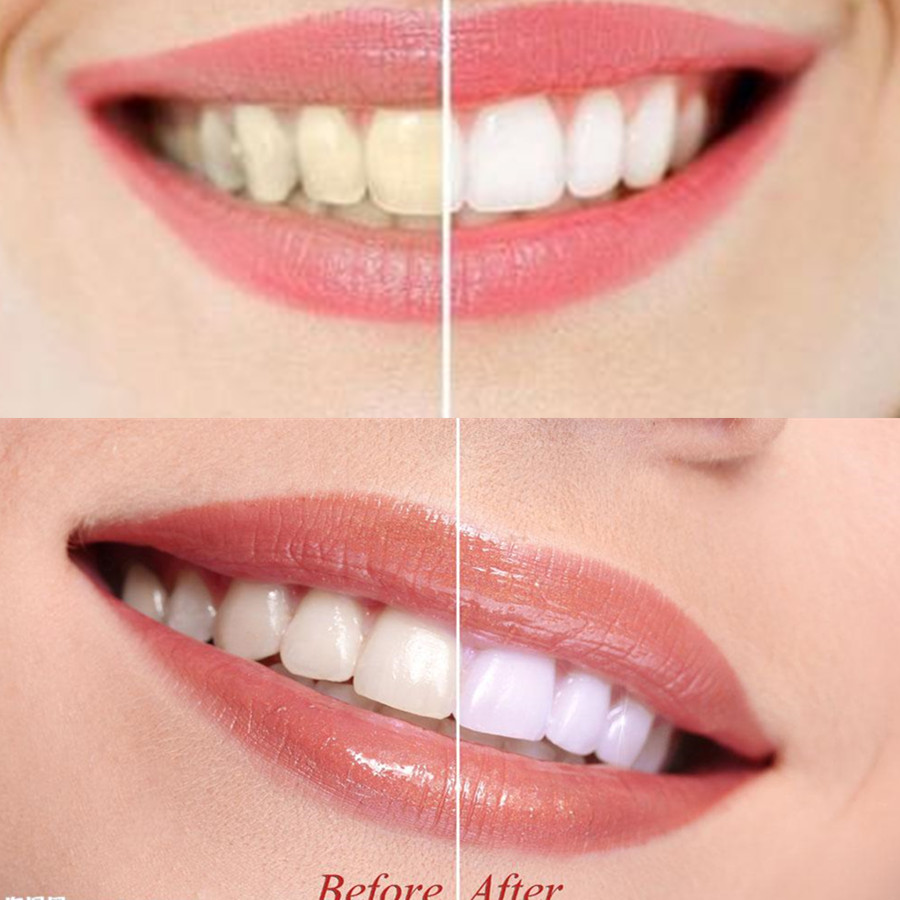 Poudre de charbon de bambou po - Teeth Whitening Charcoal avis et prix