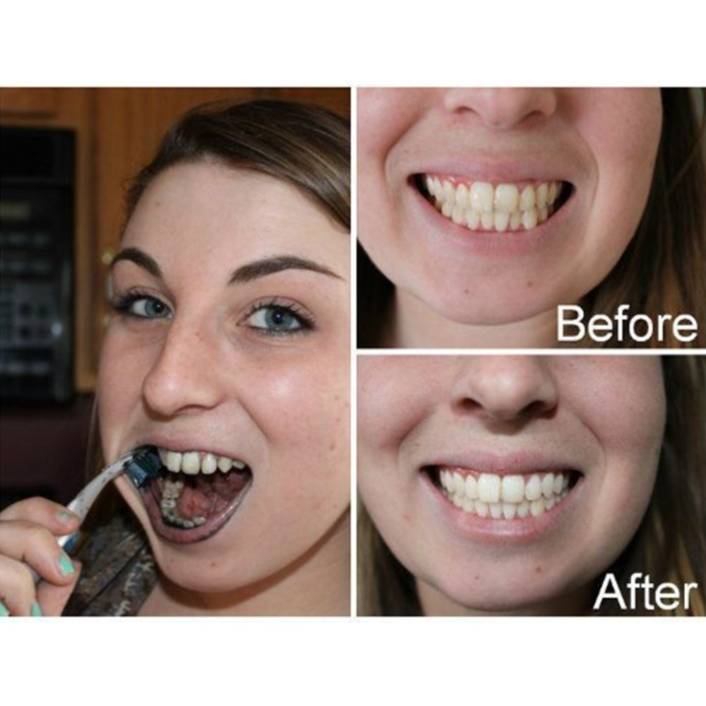 Poudre de charbon de bambou po - Teeth Whitening Charcoal avis et prix