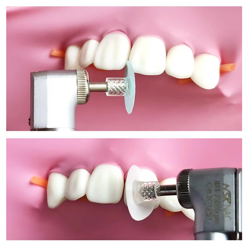 40 disques de polissage dentai - Teeth Whitening Kit Professional avis et prix