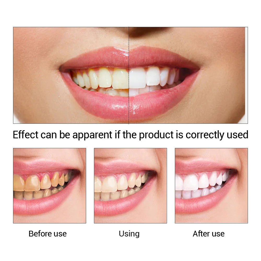FTEENPLY poudre d'essence de b - Teeth Whitening Powder avis et prix