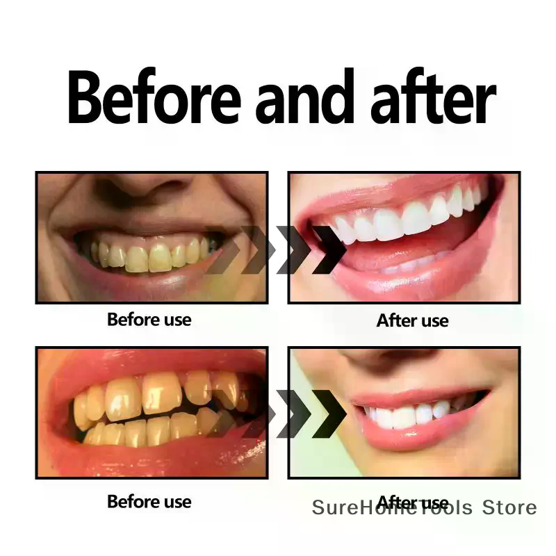 Poudre de charbon de bambou po - Teeth Whitening Charcoal avis et prix