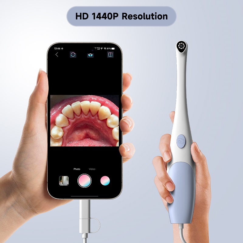 Caméra endoscopique orale 1440 - Teeth Whitening Video avis et prix