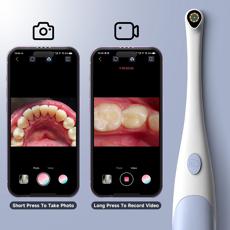 Caméra endoscopique orale 1440 - Teeth Whitening Video avis et prix