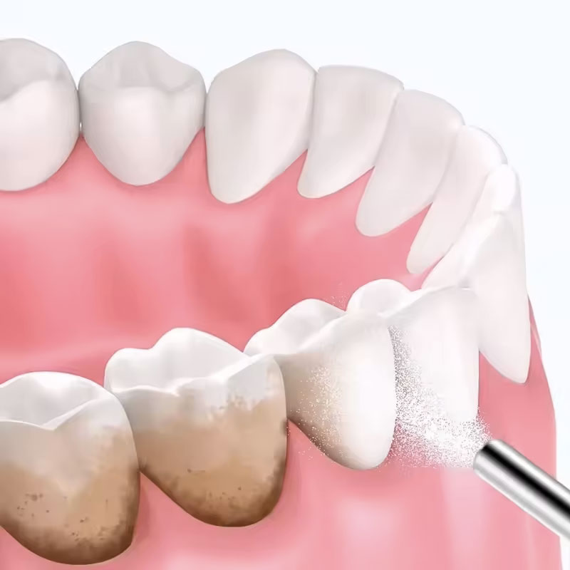 Poudre de sablage dentaire 130 - Teeth Whitening Co avis et prix