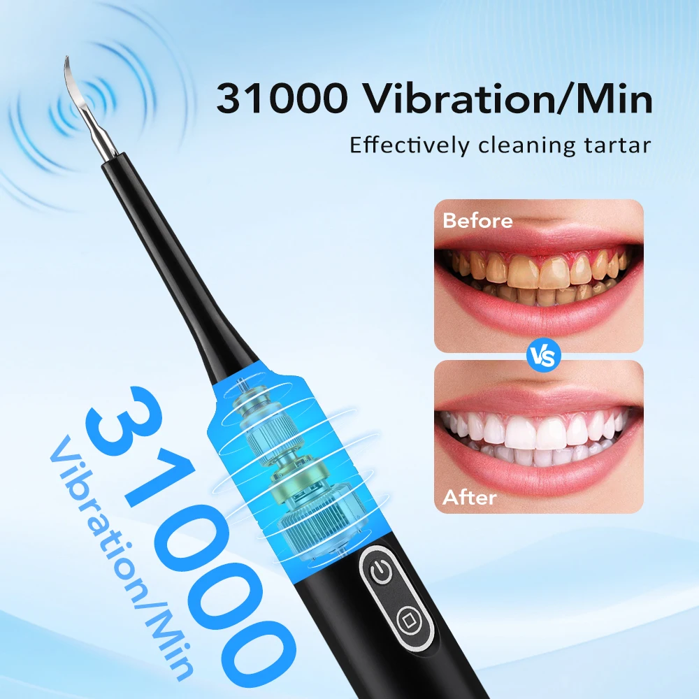 Détartreur dentaire électrique - Teeth Whitening Kit Professional avis et prix